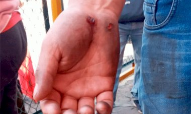 12 mujeres golpeadas y 3 detenidos por represión en Zinacantepec